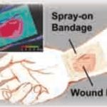 transparent smart bandage